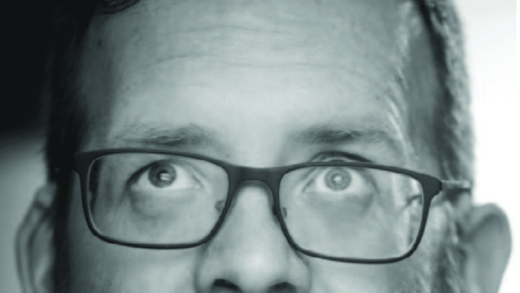 An image of the top of a persons head, they are looking up.