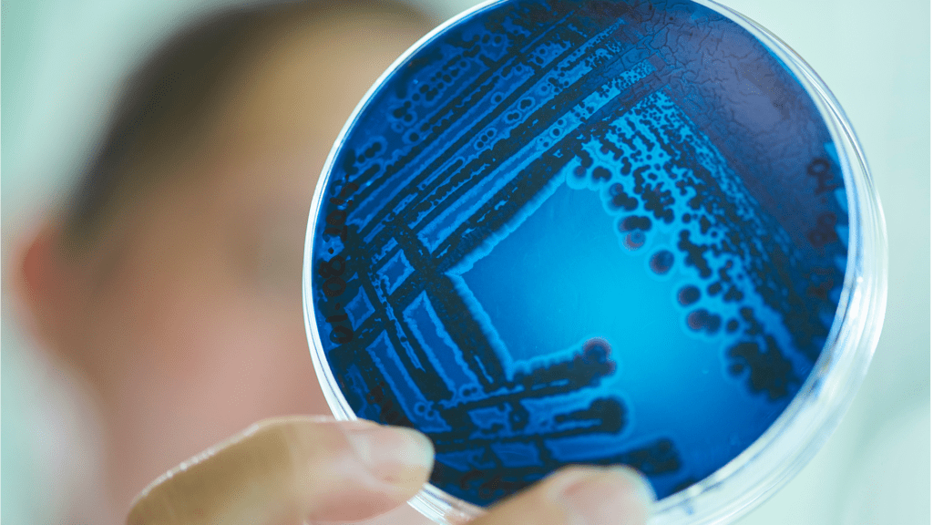 An image of Petri dish
