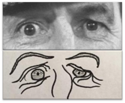 Two pares of eyes, one real and one cartoon, showing the emotion of panic.
