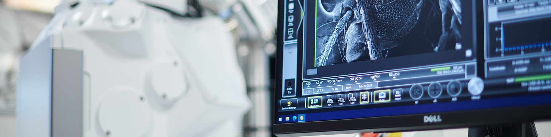 Computer displaying an ultrasound