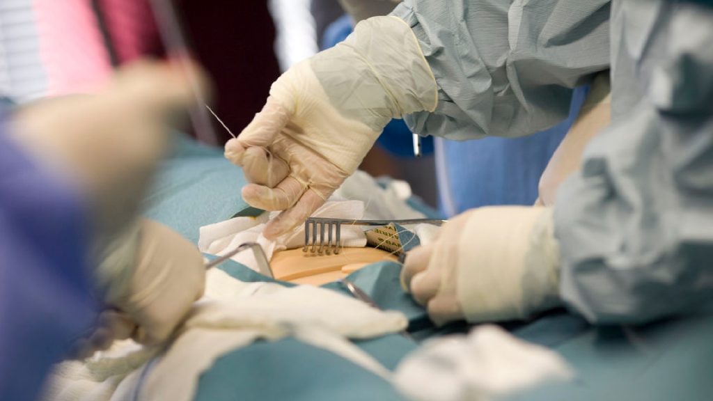 Multiple surgeons are stood around an operating table. One is performing a medical procedure on the exposed stomach of a practice mannequin.