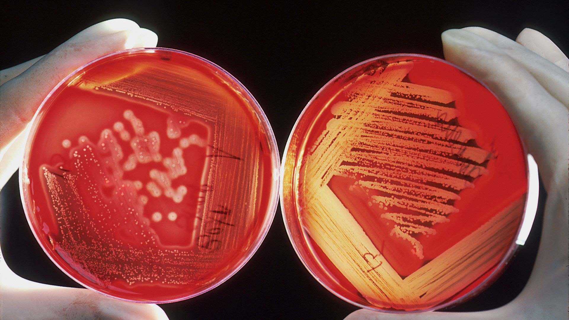 Two petri dishes are held side by side in two hands wearing white surgical gloves.
